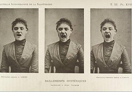 Fotos del Hospital de la Salpêtrière.