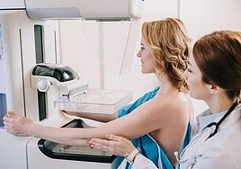 La rebaja a 45 años del cribado de cáncer de mama permitirá proteger a 85.000 mujeres más
