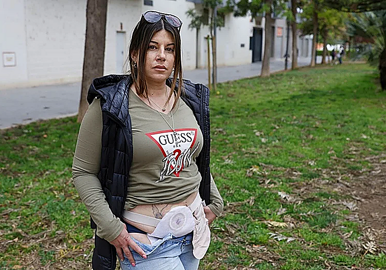El calvario de Tania: «Me hizo creer que me mutiló para salvarme y estoy muerta en vida»