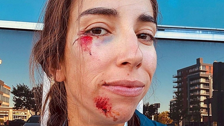 El drama de Sandra Alonso, la nueva ciclista del Laboral Kutxa: no disputará hoy el Mundial tras un grave accidente