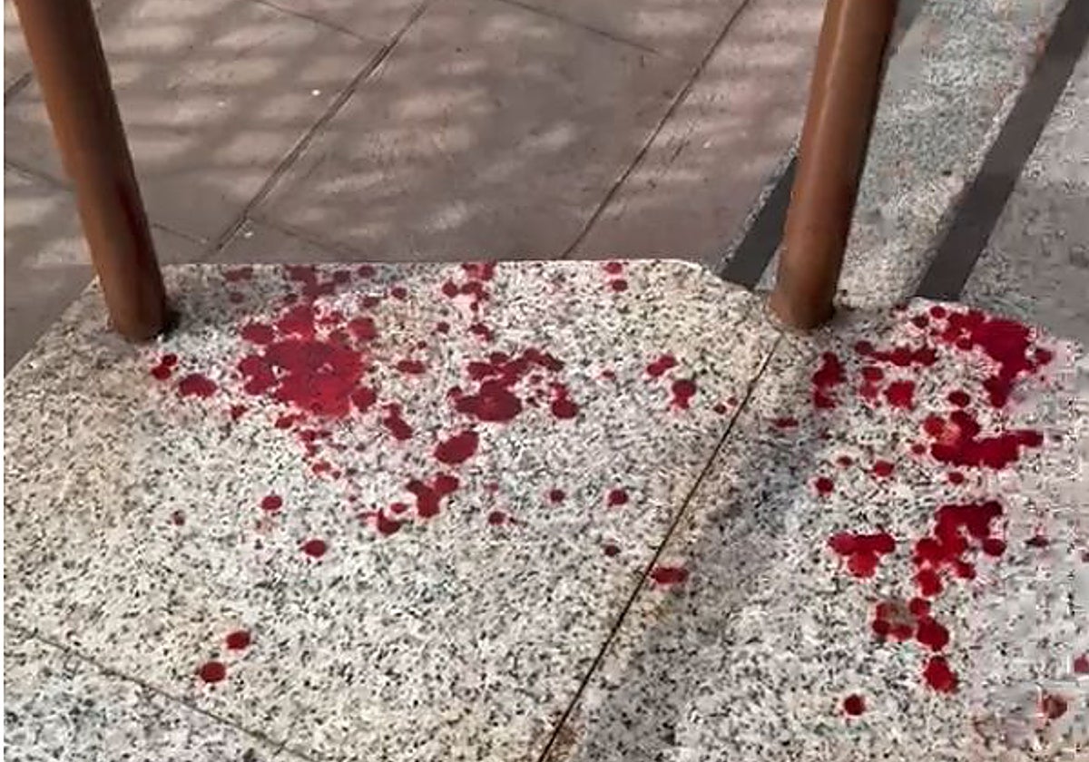 «Me agarraron del cuello y apalearon al pedirles que no entraran en la barra»
