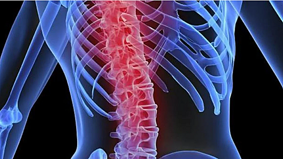 Osakidetza analiza 17 casos de daño ocular por un fármaco para la osteoporosis