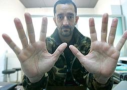 El paciente «se puso a llorar cuando vio las piernas»