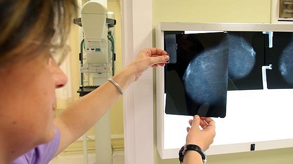 Una doctora observa una mamografía. 