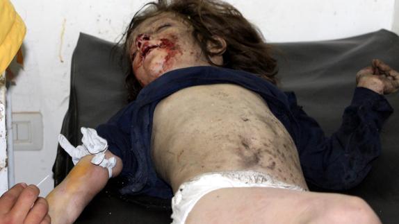 Un niño herido en Idlib. 