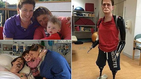 Alex Lewis, feliz junto a su familia y sus nuevas prótesis.