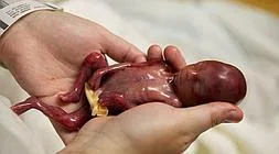 El diario de un feto, 9 meses desde dentro