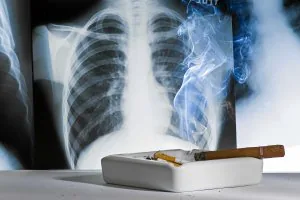 El cáncer de pulmón está ligado en un 95% al consumo de tabaco. La deshabituación es el mejor antídoto. ::                         EL CORREO