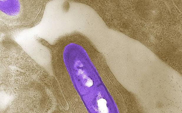Bacteria de la listeria 