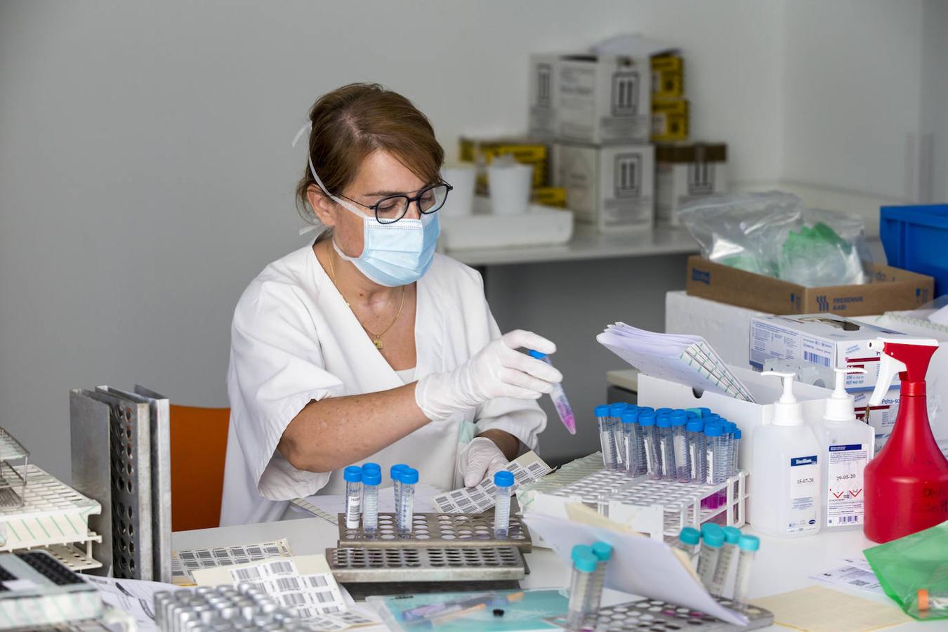 El laboratorio de Microbiología realiza más de 1.500 PCR diarias en busca del patógeno, oculto en un 6% de las pruebas.