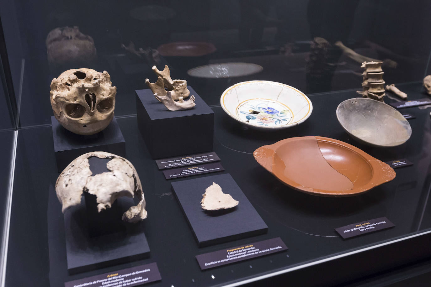 El Museo de Prehistoria y Arqueología de Cantabria (MUPAC) acoge hasta final de año una exposición que muestra cómo los restos humanos sirven para conocer la historia de la región a través de la información que aportan sobre cómo vivieron y murieron las personas.