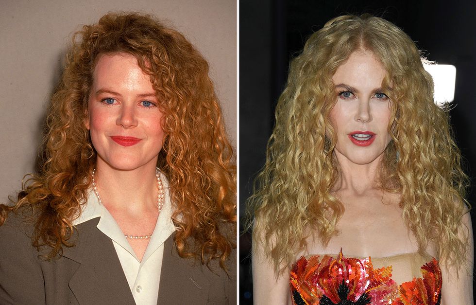 Nicole Kidman.