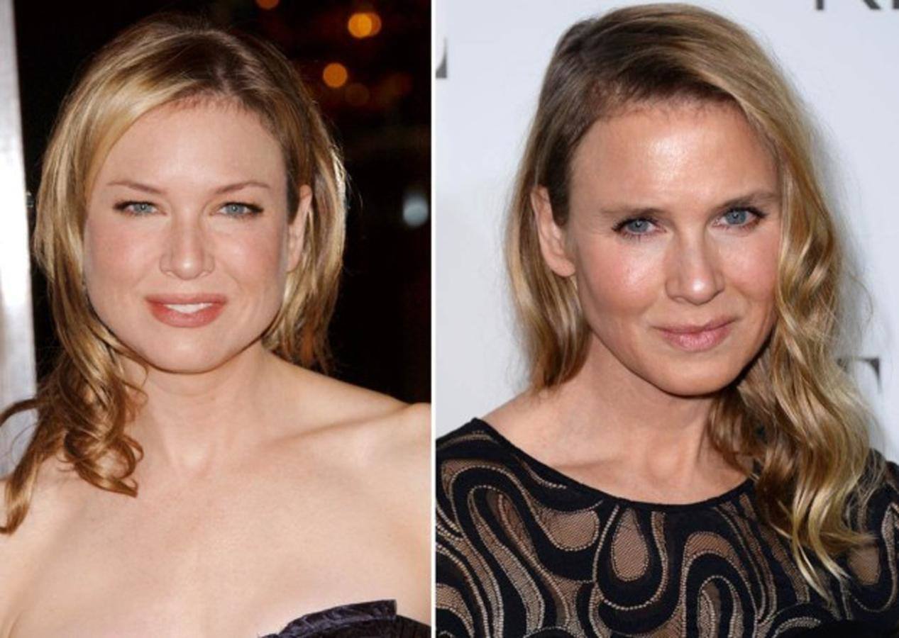 Renée Zellweger.