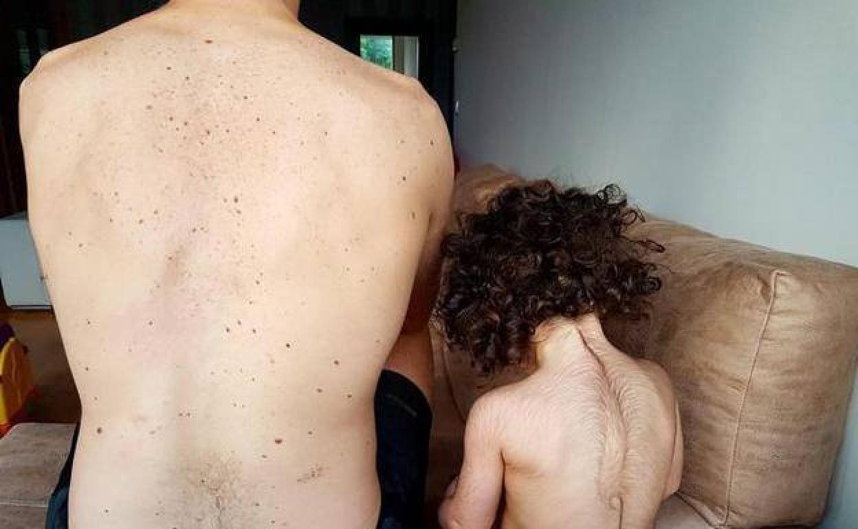 Una de las niñas afectadas por el falso omeprazol.