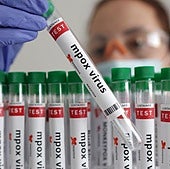 Muestras del virus de la viruela del mono para analizar en un laboratorio. reuters