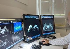 Unidad de Imagen de la Mujer de HT Médica en el Hospital Santa Clotilde ofrece un servicio integral centrado en la salud mamaria.