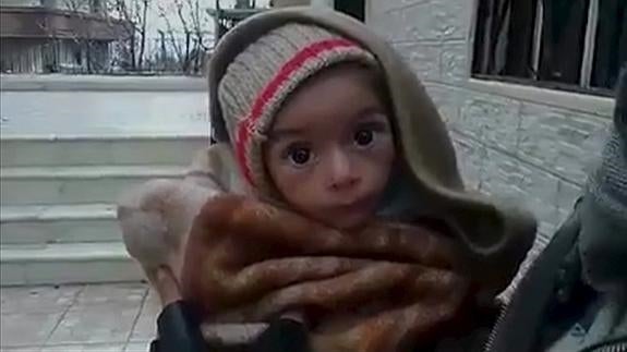 Un niño desnutrido en Madaya.