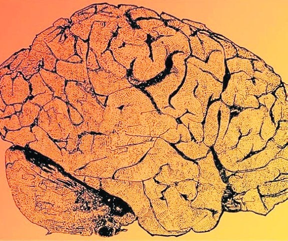 El cerebro, ese gran desconocido. 