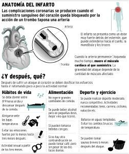 El sedentarismo multiplica por ocho el riesgo de infarto