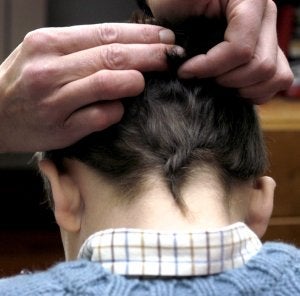 Los más 'piojosos' de España