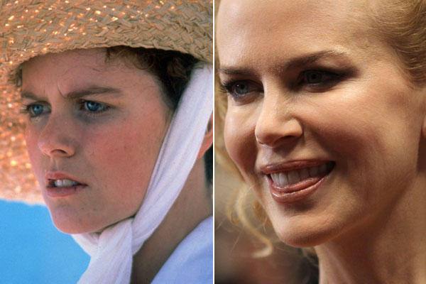 Nicole Kidman es una de las actrices peor operadas de la historia. Realmente su paso por el quirófano ha sido dramático.