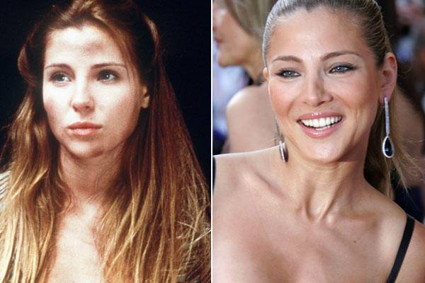 Elsa Pataky ha sabido sacar rentabilidad a sus 'retoques': Liposucción de mejillas, resaltación de pómulos, delineación y aumento de los labios, blanqueamiento de dientes, mamoplastia de aumento y lipoescultura... Ella lo niega.