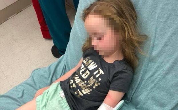 Una niña de cinco años sufre parálisis por la picadura de una garrapata