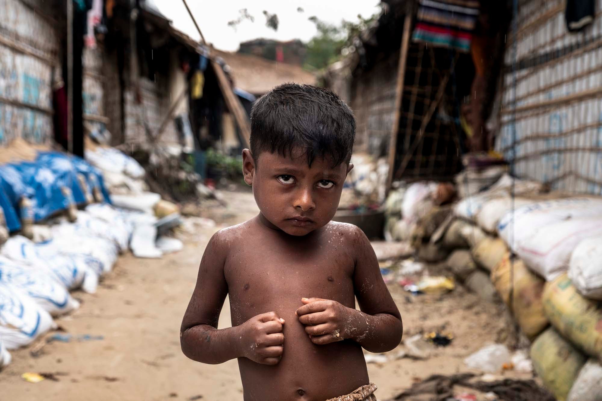 Los más de 800.000 refugiados rohingya que vive en los campos de refugiados de Bangladés, la mitad de ellos niños y niñas, está sufriendo el comienzo de las fuertes lluvias del monzón