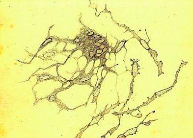 Imagen secundaria 1 - Multitudinario entierro en Buenos Aires del investigador de Portillo, microglía dibujada por el investigador y Pío del Río Hortega al microscopio.