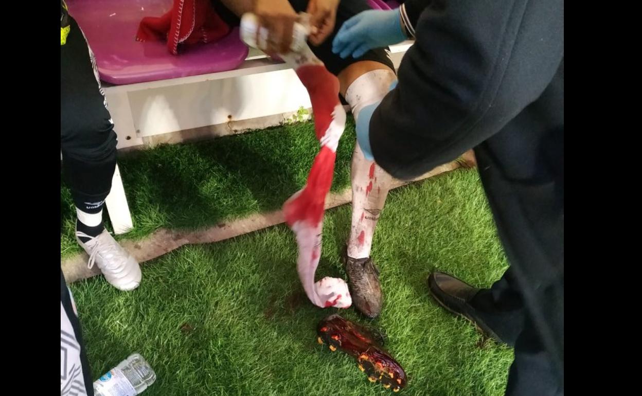 La pierna y la bota de Néstor Calderón, con abundante sangre. 