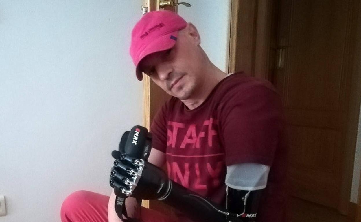 Ramon Fernández ha conseguido manejarse con su prótesis biónica con gran facilidad. 