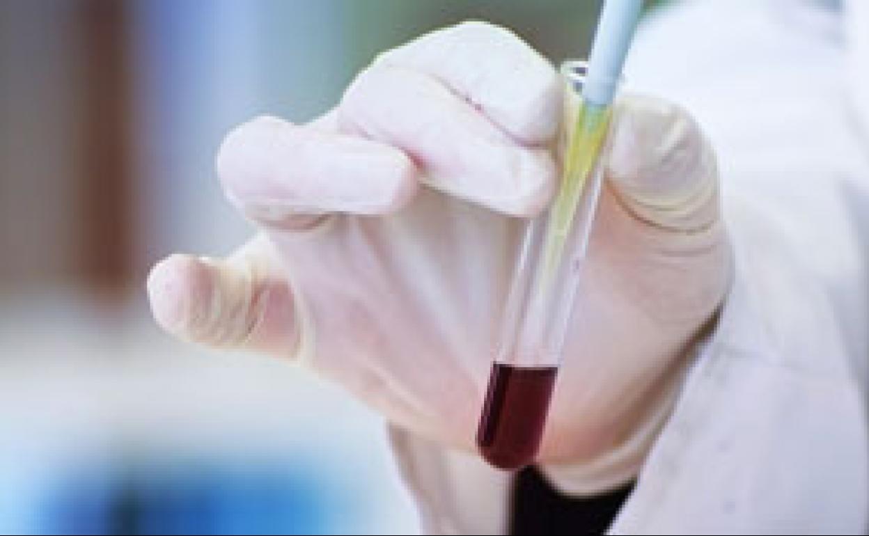 Coronavirus en Salamanca: La Usal propone hacer test PCR para la comunidad universitaria y para la sociedad salmantina en colaboración con las distintas instituciones