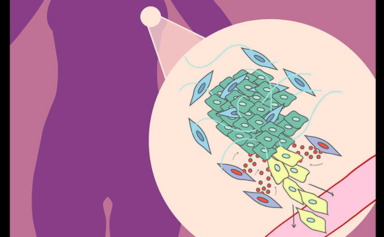 Investigadores del Centro del Cáncer de Salamanca relacionan el gen SNAI2 con la progresión del cáncer de mama