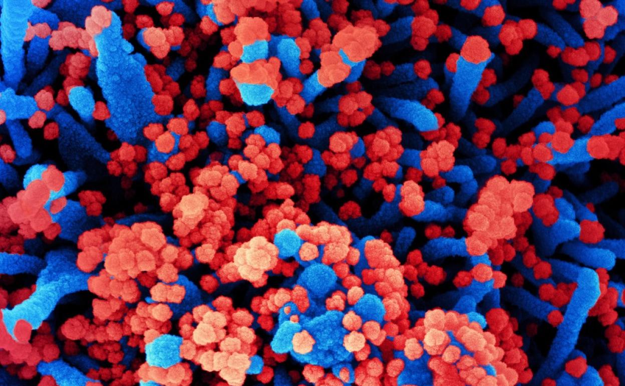 Micrografía electrónica de barrido de células humanas (azul) infectadas con SARS-CoV-2 (rojo).