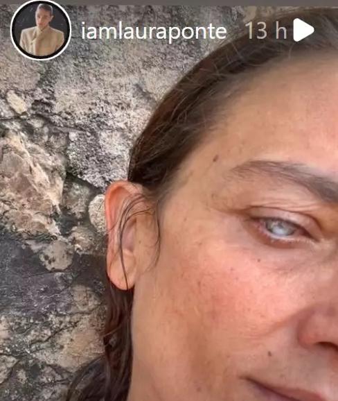 Estado del ojo de Laura Ponte. 