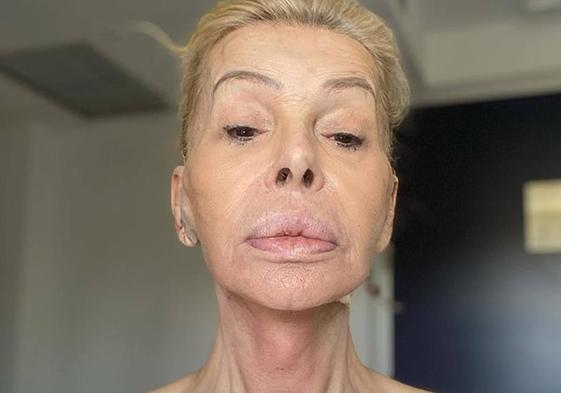 Bibiana Fernández, durante su ingreso en el hospital.