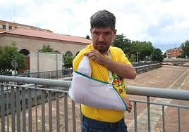 Mariano Roncero muestra las lesiones tras el accidente en el paseo de Zorrilla.