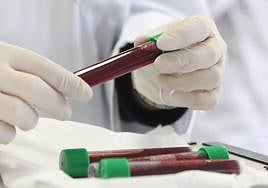 Muestras para la prueba del talón.