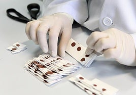 Muestras de sangre procedentes del talón de recién nacidos.