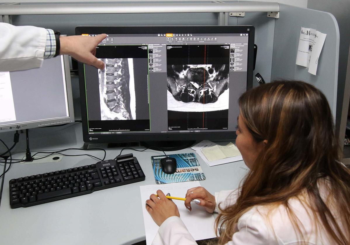 Personal del servicio de Radiodiagnóstico del Hospital General de Segovia.