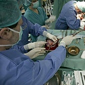 La Junta crea confusión sobre el reparto de trasplantes cardíacos entre Valladolid y Salamanca