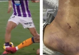 Entrada de Mbappé sobre Anuar y sus consecuencias