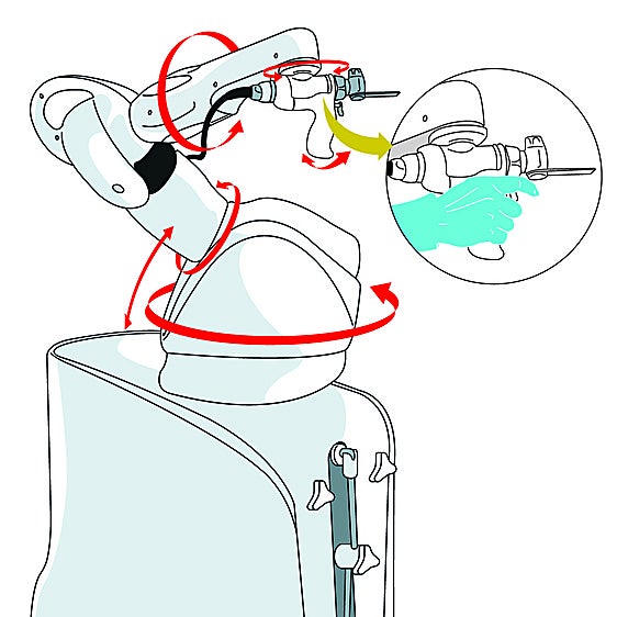 Así funciona el robot Mako con el que operan traumatólogos del Hospital Clínico