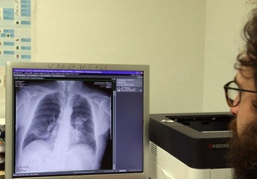 El cáncer crecerá en Segovia hasta los 1.323 diagnósticos anuales en 2050