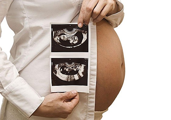 Una mujer embarazada muestra una ecografía.