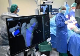 Operación de cadera en la que los cirujanos ortopédicos del Hospital Clínico Universitario de Valladolid emplean el brazo robótico Mako.
