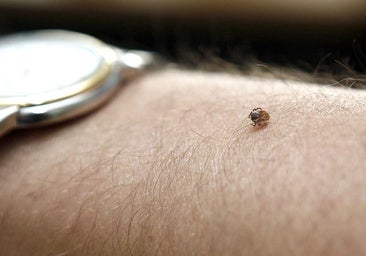 Alta médica en Madrid un mes después para el ingresado en Salamanca por fiebre hemorrágica de Crimea-Congo