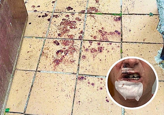 Sangre en el umbral de la casa. A la derecha, Álvaro muestra las heridas.