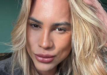 Muere a los 31 años el influencer Júnior Dutra tras someterse a la cirugía de moda 'foxy eyes'
