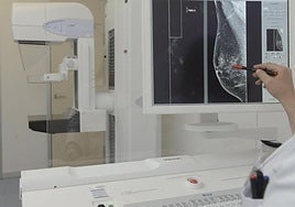 Un especialista observa una mamografía.